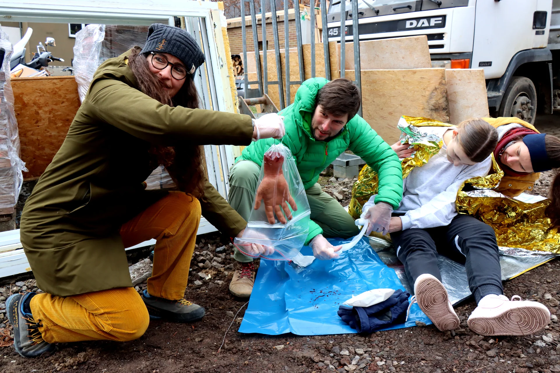 Abgetrennte Hand | © DAV Koblenz